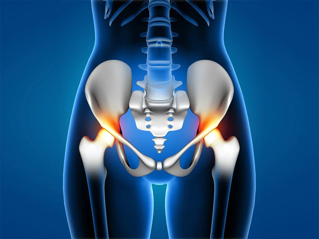 Crowe Tip II ve III Gelişimsel Kalça Displazisinde Yüksek Kalça Merkezi ile Anatomik Rekonstrüksiyon Tekniğinin Karşılaştırılması: Retrospektif Klinik Çalışma.